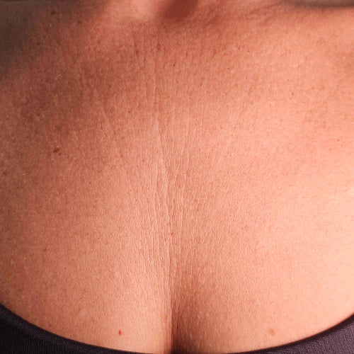 Carol - Before the Skinlet