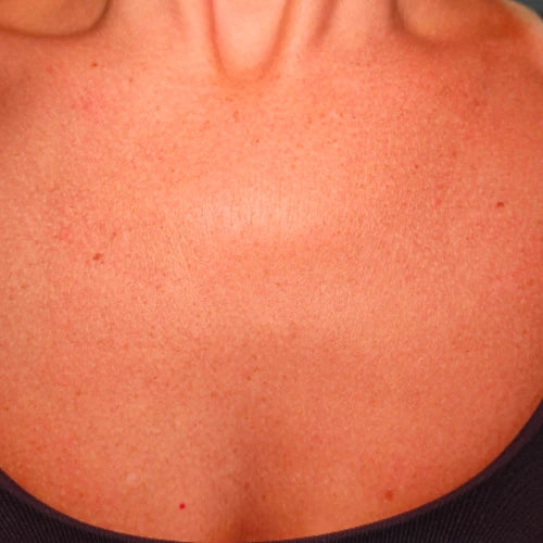 Carol - After the Skinlet